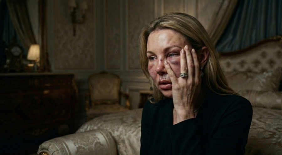 Makthi i "Helmit të Gjarprit" në Shoqërinë e Lartë: Ëndrra e Rinimit Përfundoi në Katastrofë!